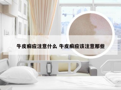 牛皮癣应注意什么 牛皮癣应该注意那些