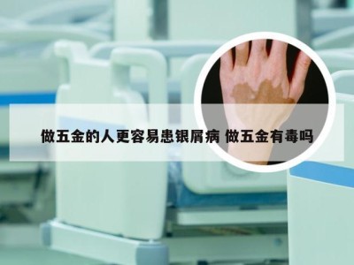 做五金的人更容易患银屑病 做五金有毒吗