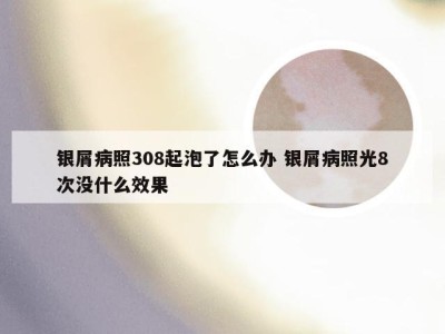 银屑病照308起泡了怎么办 银屑病照光8次没什么效果
