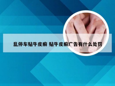 乱停车贴牛皮癣 贴牛皮癣广告有什么处罚