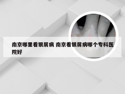 南京哪里看银屑病 南京看银屑病哪个专科医院好
