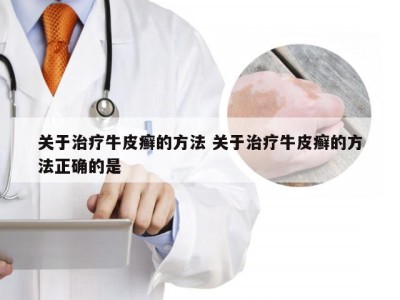关于治疗牛皮癣的方法 关于治疗牛皮癣的方法正确的是