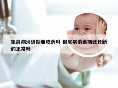 银屑病消退期要吃药吗 银屑病消退期还长新的正常吗