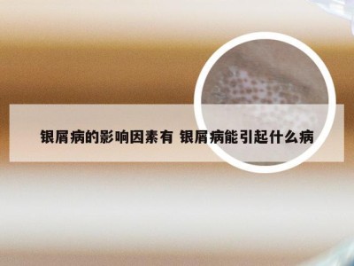 银屑病的影响因素有 银屑病能引起什么病