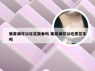 银屑病可以吃花旗参吗 银屑病可以吃煮花生吗
