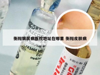 衡阳银屑病医院地址在哪里 衡阳皮肤病