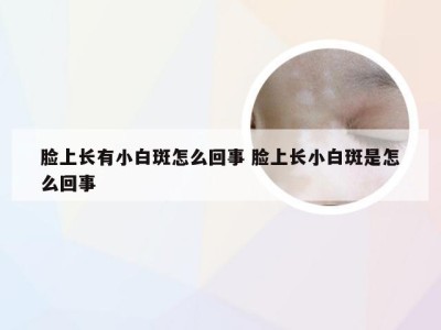 脸上长有小白斑怎么回事 脸上长小白斑是怎么回事