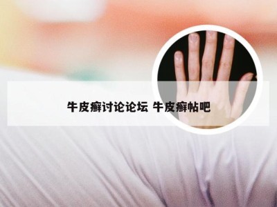 牛皮癣讨论论坛 牛皮癣帖吧