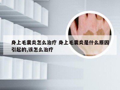 身上毛囊炎怎么治疗 身上毛囊炎是什么原因引起的,该怎么治疗