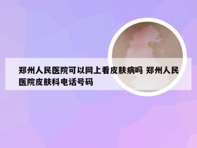郑州人民医院可以网上看皮肤病吗 郑州人民医院皮肤科电话号码