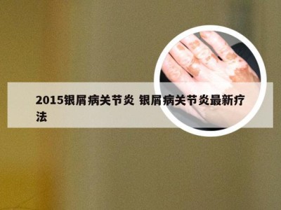 2015银屑病关节炎 银屑病关节炎最新疗法