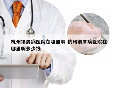 杭州银屑病医院在哪里啊 杭州银屑病医院在哪里啊多少钱