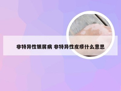 非特异性银屑病 非特异性皮疹什么意思