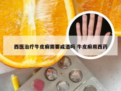 西医治疗牛皮癣需要戒酒吗 牛皮癣用西药