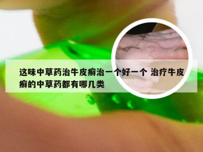 这味中草药治牛皮癣治一个好一个 治疗牛皮癣的中草药都有哪几类