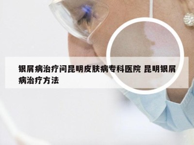 银屑病治疗问昆明皮肤病专科医院 昆明银屑病治疗方法