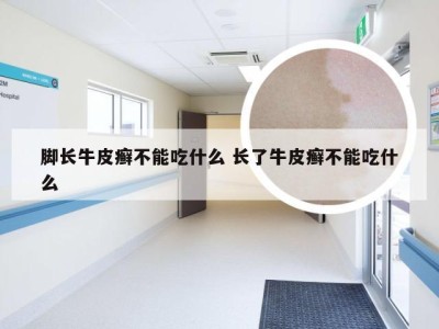 脚长牛皮癣不能吃什么 长了牛皮癣不能吃什么