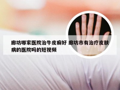 廊坊哪家医院治牛皮癣好 廊坊市有治疗皮肤病的医院吗的短视频