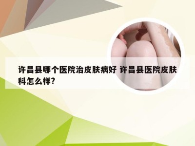 许昌县哪个医院治皮肤病好 许昌县医院皮肤科怎么样?