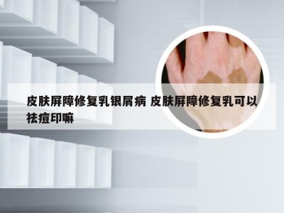 皮肤屏障修复乳银屑病 皮肤屏障修复乳可以祛痘印嘛