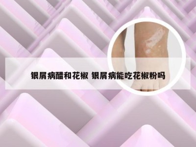 银屑病醋和花椒 银屑病能吃花椒粉吗