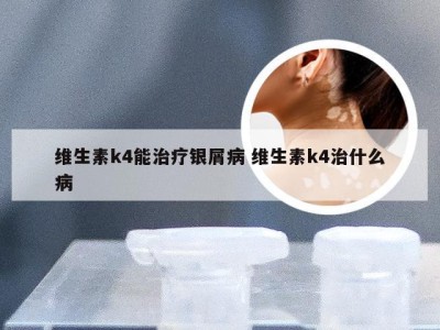 维生素k4能治疗银屑病 维生素k4治什么病
