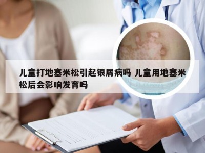 儿童打地塞米松引起银屑病吗 儿童用地塞米松后会影响发育吗