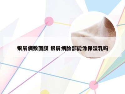银屑病敷面膜 银屑病脸部能涂保湿乳吗