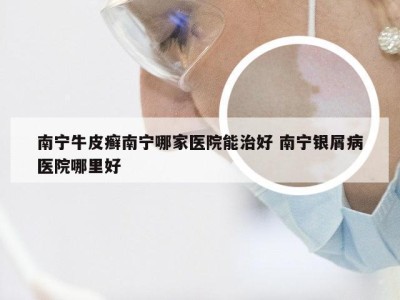 南宁牛皮癣南宁哪家医院能治好 南宁银屑病医院哪里好