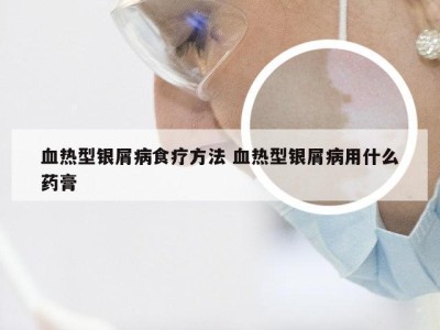 血热型银屑病食疗方法 血热型银屑病用什么药膏