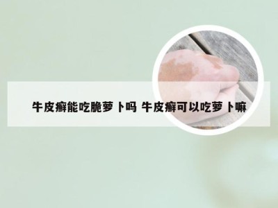 牛皮癣能吃脆萝卜吗 牛皮癣可以吃萝卜嘛