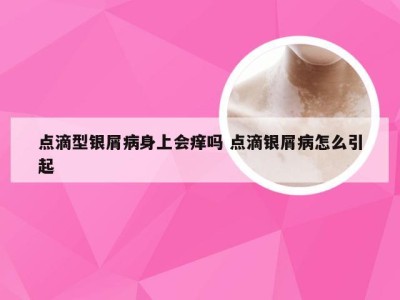 点滴型银屑病身上会痒吗 点滴银屑病怎么引起