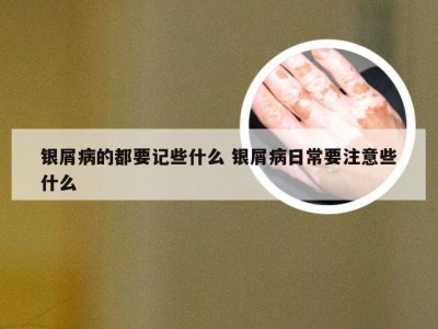银屑病的都要记些什么 银屑病日常要注意些什么