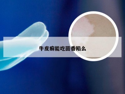 牛皮癣能吃茴香陷么
