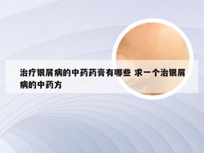 治疗银屑病的中药药膏有哪些 求一个治银屑病的中药方