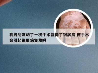 我男朋友动了一次手术就得了银屑病 做手术会引起银屑病复发吗