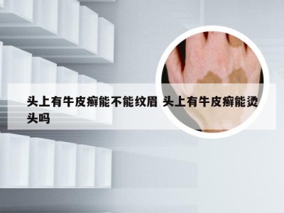 头上有牛皮癣能不能纹眉 头上有牛皮癣能烫头吗