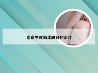 南京牛皮癣比较好的治疗