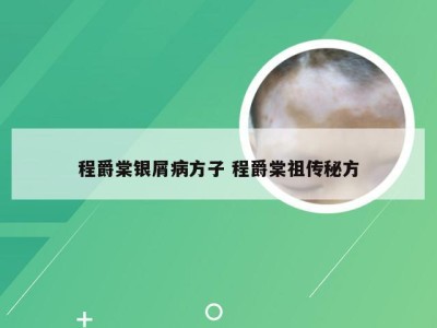 程爵棠银屑病方子 程爵棠祖传秘方
