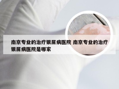 南京专业的治疗银屑病医院 南京专业的治疗银屑病医院是哪家