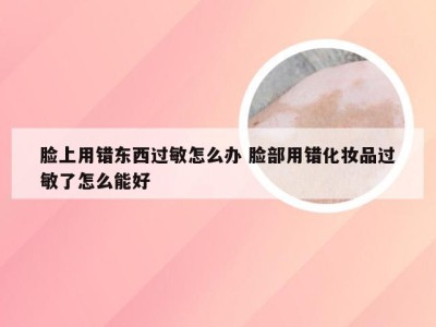 脸上用错东西过敏怎么办 脸部用错化妆品过敏了怎么能好