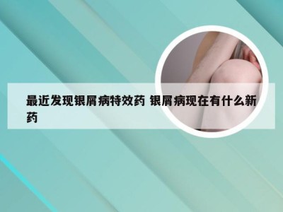 最近发现银屑病特效药 银屑病现在有什么新药