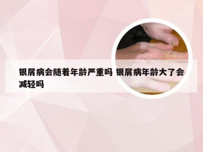 银屑病会随着年龄严重吗 银屑病年龄大了会减轻吗