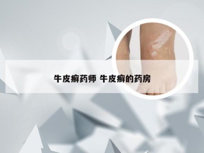 牛皮癣药师 牛皮癣的药房