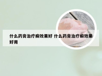 什么药膏治疗癣效果好 什么药膏治疗癣效果好用