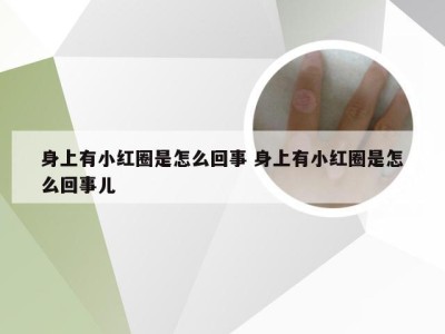 身上有小红圈是怎么回事 身上有小红圈是怎么回事儿