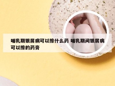 哺乳期银屑病可以擦什么药 哺乳期间银屑病可以擦的药膏