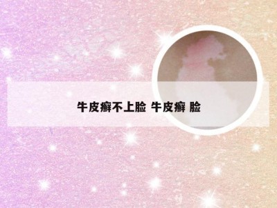 牛皮癣不上脸 牛皮癣 脸
