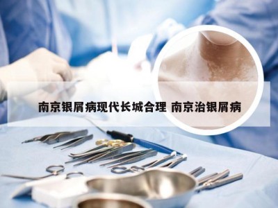 南京银屑病现代长城合理 南京治银屑病