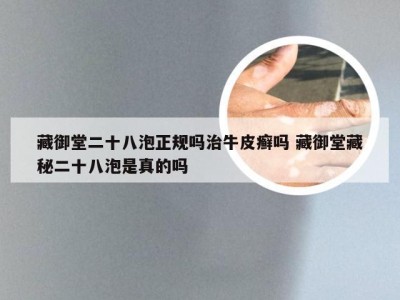 藏御堂二十八泡正规吗治牛皮癣吗 藏御堂藏秘二十八泡是真的吗